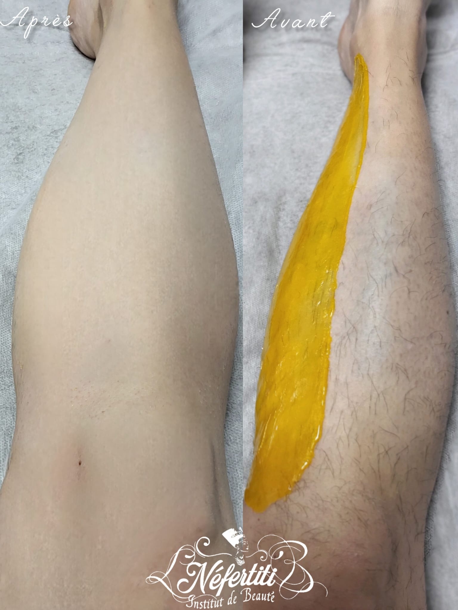 Photo de la catégorie EPILATION FEMME