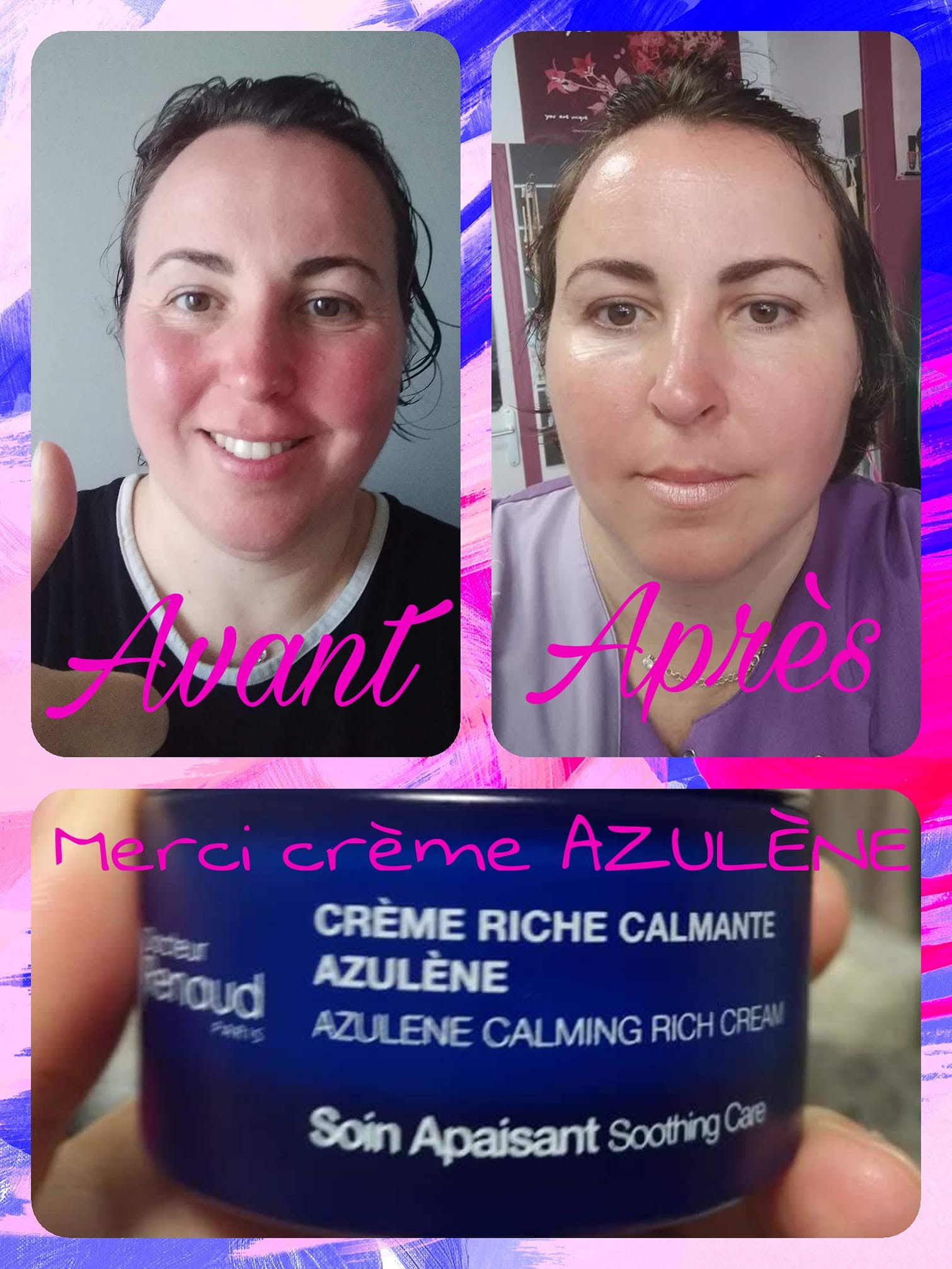 Crème magique pour peau ultrasensible, irritée, coup de soleil, sèche etc....résultat dès la 1ère application !