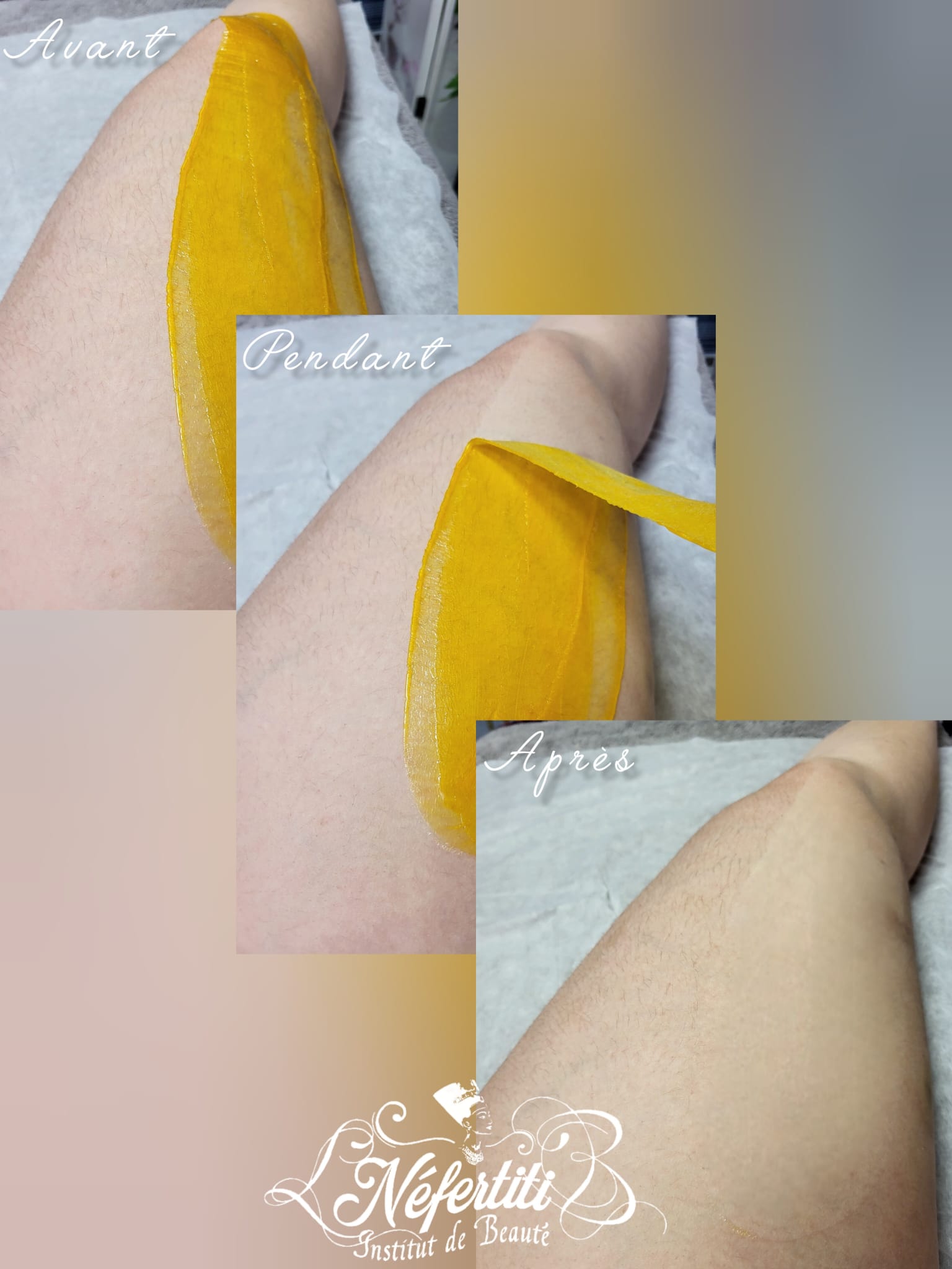 Photo de la catégorie EPILATION FEMME