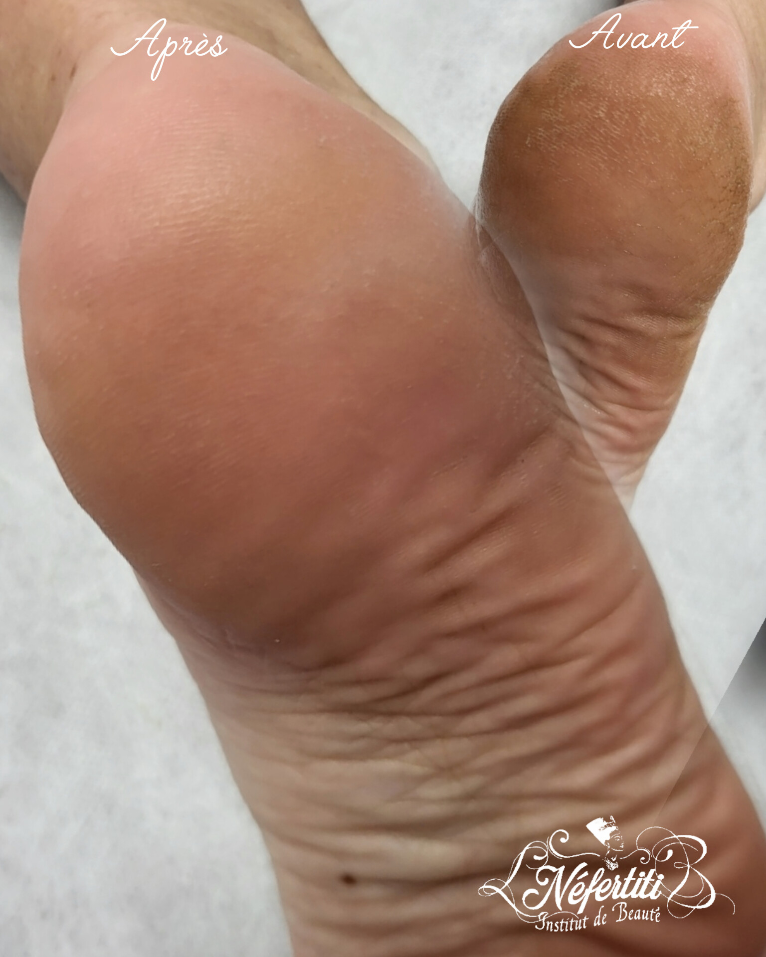 Photo de la catégorie BEAUTE DES PIEDS