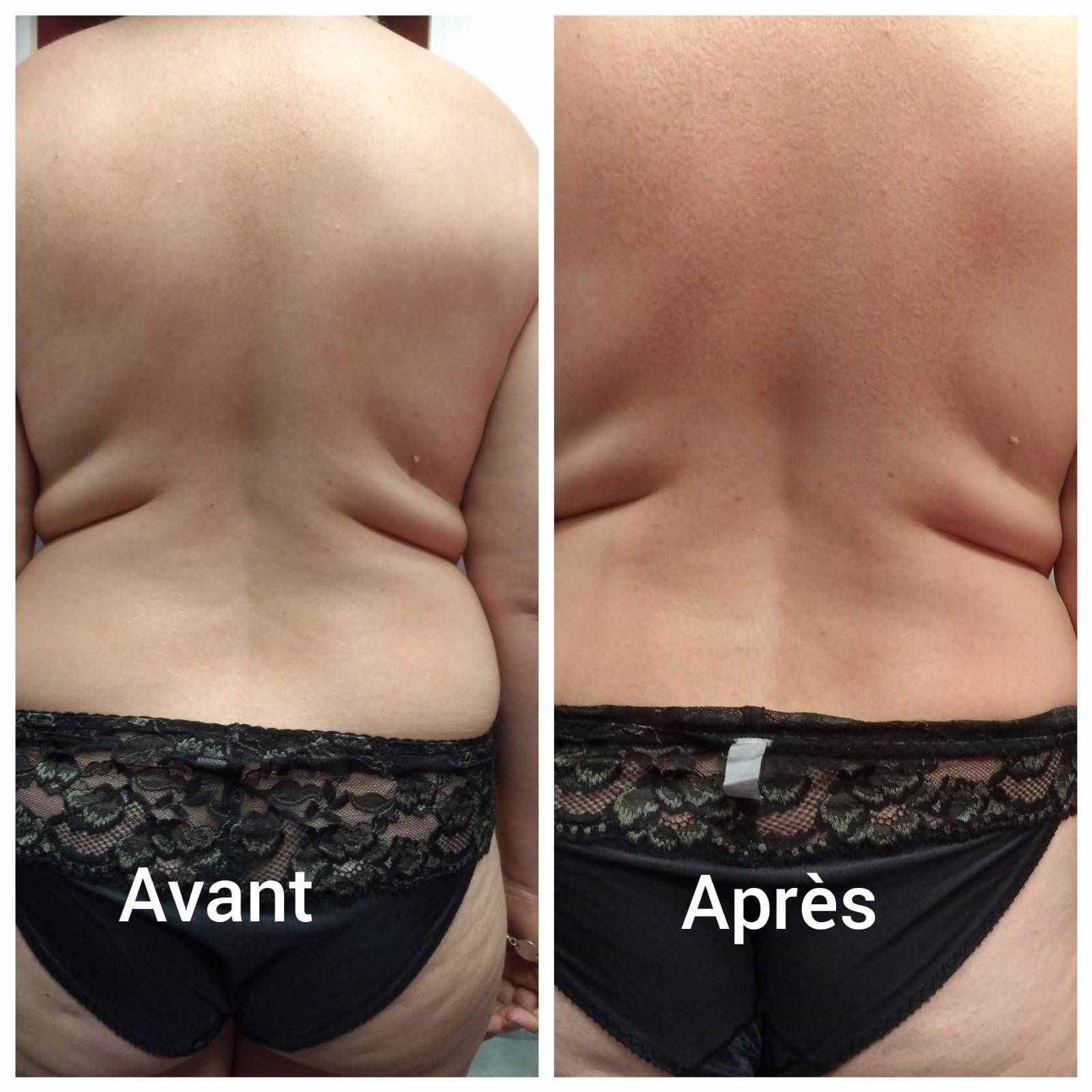 Photo de la catégorie MASSAGES SPECIFIQUES