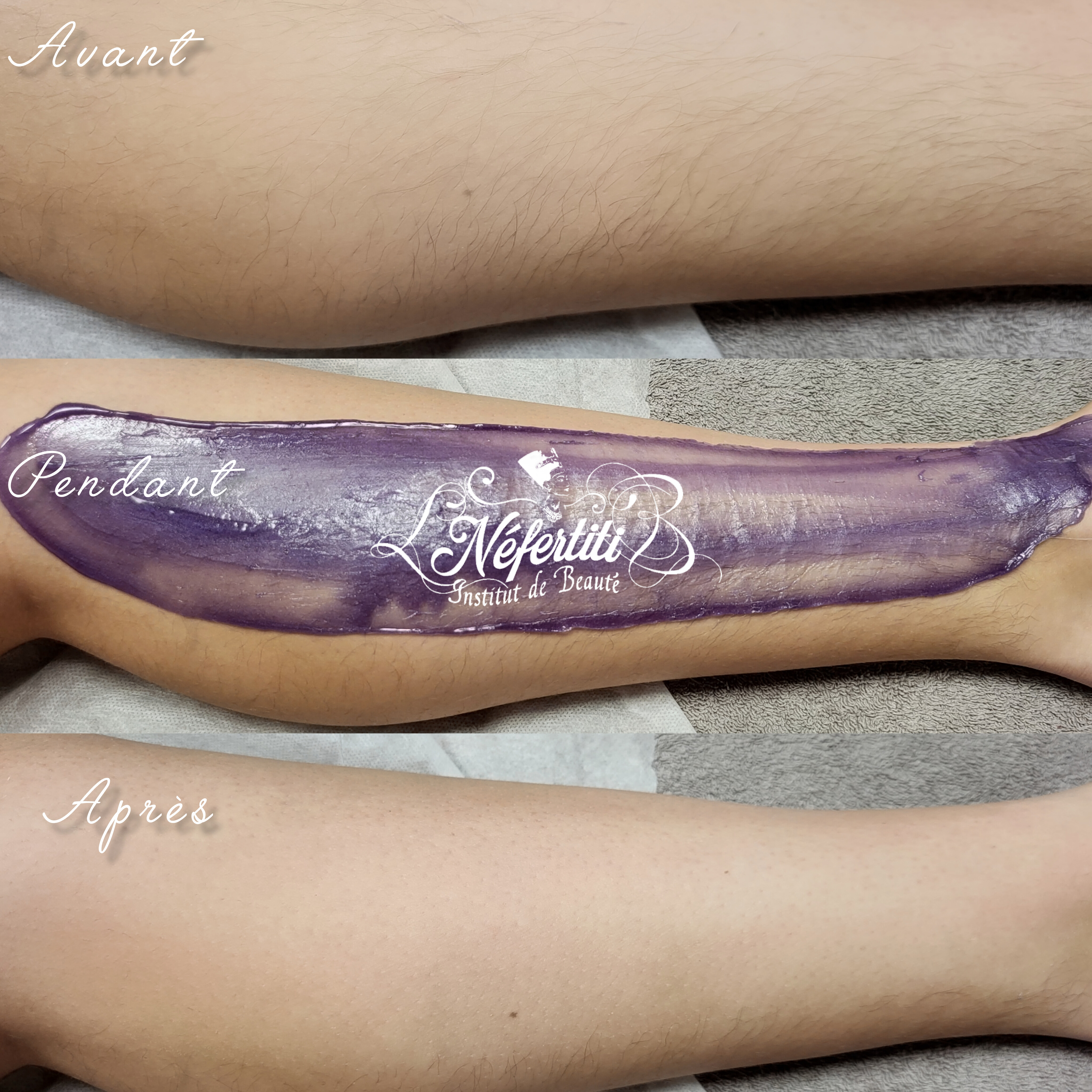 Photo de la catégorie EPILATION FEMME